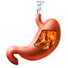 Gyomorégés, reflux