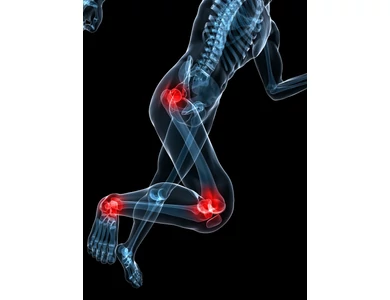 Miért romlik ősszel az ízületi gyulladás?