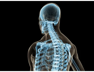 Előzd meg a csontritkulást!