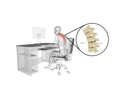 Életmódunk és a porckorongsérv