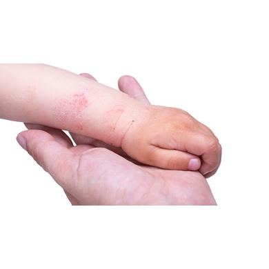 mazi sebek diabetes mellitus seb lábak és a kezelés